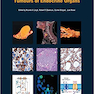 WHO Classification of Tumours of Endocrine Organs, 4th Edition2017 طبقه بندی تومورهای اندام های غدد درون ریز