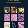 WHO Classification of Tumours of the Eye, 4th Edition2018 طبقه بندی تومورهای چشم