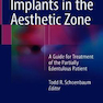 Implants in the Aesthetic Zone 1st Edition2018 کاشت در منطقه زیبایی