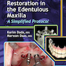 Esthetic Implant Restoration in the Edentulous Maxilla2014 ترمیم ایمپلنت زیبایی در فک بالا