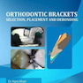 Orthodontic Brackets: Selection,Placement and Debonding2015 براکت های ارتودنسی: انتخاب ، جاگذاری و رد کردن