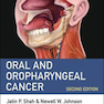 Oral and Oropharyngeal Cancer 2nd Edition2018 سرطان دهان و حلق