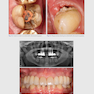 Clinical Photography in Dentistry 1st Edition 2019