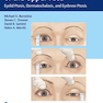 Ophthalmic Plastic Surgery of the Upper Face2019 جراحی پلاستیک چشم از قسمت فوقانی صورت