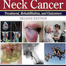 Head and Neck Cancer Second Edition2014 سرطان گردن و سر