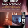 Total Ankle Replacement: An Operative Manual First Edition2014 تعویض کامل مچ پا: یک کتابچه راهنمای عملیاتی