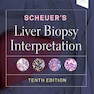 Scheuer’s Liver Biopsy Interpretation 10th Edition 2020