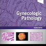 Gynecologic Pathology, 2nd Edition2020