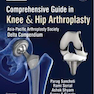 Comprehensive Guide In Knee - Hip Arthroplasty