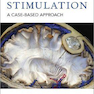 Deep Brain Stimulation: A Case-based Approach 1st Edition