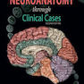 Neuroanatomy through Clinical Cases, 2nd Edition2010 عصب کشی از طریق موارد بالینی