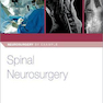 Spinal Neurosurgery (Neurosurgery by Example)2019جراحی مغز و اعصاب نخاعی (جراحی مغز و اعصاب به عنوان مثال)
