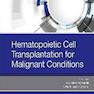 Hematopoietic Cell Transplantation for Malignant Conditions پیوند سلول خونساز برای شرایط بدخیم