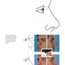 Photographic Atlas of Rhinoplasty : Problem-solving and Troubleshootingاطلس عکاسی جراحی زیبایی بینی: حل مشکلات و عیب یابی