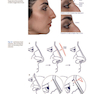 Photographic Atlas of Rhinoplasty : Problem-solving and Troubleshootingاطلس عکاسی جراحی زیبایی بینی: حل مشکلات و عیب یابی