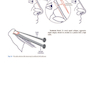 Photographic Atlas of Rhinoplasty : Problem-solving and Troubleshooting