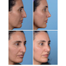 Photographic Atlas of Rhinoplasty : Problem-solving and Troubleshootingاطلس عکاسی جراحی زیبایی بینی: حل مشکلات و عیب یابی