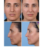 Photographic Atlas of Rhinoplasty : Problem-solving and Troubleshootingاطلس عکاسی جراحی زیبایی بینی: حل مشکلات و عیب یابی