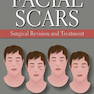 Facial Scars: Surgical Revision and Treatmentاسکارهای صورت: تجدید نظر و درمان جراحی
