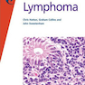 Fast Facts: Lymphoma2008حقایق سریع: لنفوم