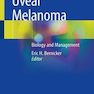 Uveal Melanoma: Biology and Management2021