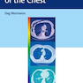 Diagnostic Imaging of the Chest 2020