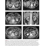 A Clinical Guide to Urologic Emergencies2021