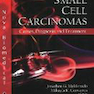 Small Cell Carcinomas : Causes, Diagnosis - Treatment2010سرطان سلولهای کوچک: علل ، تشخیص و درمان