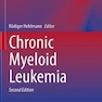 Chronic Myeloid Leukemia2021لوسمی میلوئید مزمن