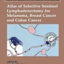 Atlas of Selective Sentinel Lymphadenectomy for Melanoma, Breast Cancer and Colon Cancer2002