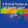 A Pictorial Treatise on Gall Bladder Cance2021رساله تصویری درباره سرطان کیسه صفرا