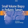 Small Volume Biopsy in Pediatric Tumorsبیوپسی حجم کوچک در تومورهای کودکان