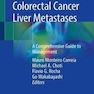 Colorectal Cancer Liver Metastases : A Comprehensive Guide to Management2020