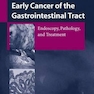 Early Cancer of the Gastrointestinal Tract : Endoscopy, Pathology, and Treatment2006
