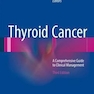 Thyroid Cancer : A Comprehensive Guide to Clinical Management