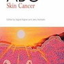 ABC of Skin Cancer سرطان پوست