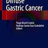 Diffuse Gastric Cancer2018سرطان معده