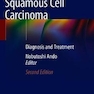 Esophageal Squamous Cell Carcinoma : Diagnosis and Treatment