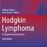 Hodgkin Lymphoma : A Comprehensive Overview2021لنفوم هوچکین: مروری جامع