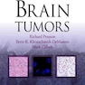 Brain Tumors2010