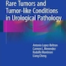 Rare Tumors and Tumor-like Conditions in Urological Pathologyتومورهای نادر و شرایط مشابه تومور در آسیب شناسی اورولوژی