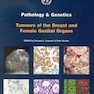 Pathology and Genetics of Tumours of the Breast and Female Genital Organs2003