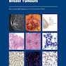 WHO Classification of Breast Tumours : WHO Classification of Tumours, Volume 2