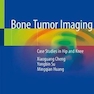 Bone Tumor Imaging : Case Studies in Hip and Kneeتصویربرداری از تومور استخوانی: مطالعات موردی در مفصل ران و زانو