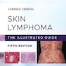 Skin Lymphoma : The Illustrated Guideلنفوم پوستی: راهنمای مصور