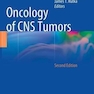 Oncology of CNS Tumorsانکولوژی تومورهای CNS