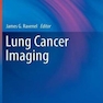 Lung Cancer and Autoimmune Disordersسرطان ریه و اختلالات خود ایمنی