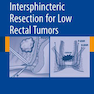 کتاب Intersphincteric Resection for Low Rectal Tumors