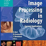 پردازش تصویر در رادیولوژی