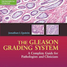 سیستم درجه بندی Gleason: راهنمای کامل برای پاتولوژیست و پزشکان